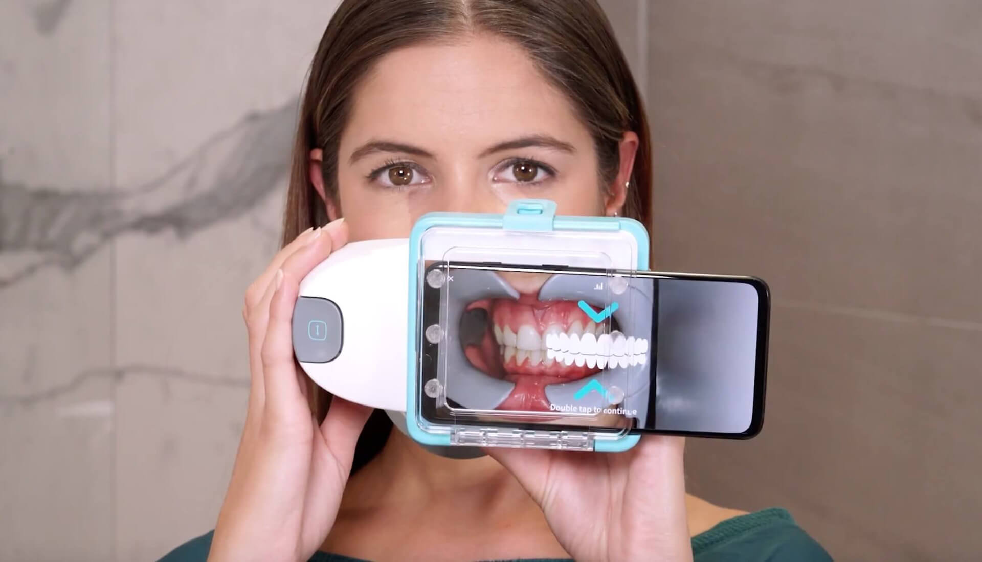 Dental Monitoring with Angel Aligners